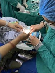 आँखा उपचारमा ऐतिहासिक  फड्को : २९ हप्तामा जन्मेको शिशुको ‘लेन्स स्पेयरिङ भिट्रेक्टोमी’ सफल